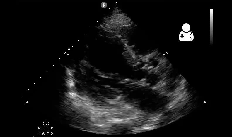 Uotw 57 Core Ultrasound